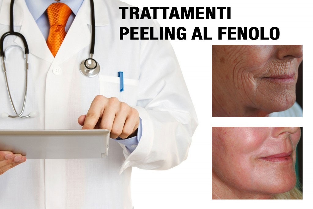 peeling al viso